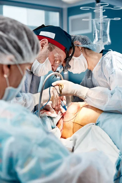 Un equipo de cirujanos en el quirófano, cirujanos profesionales realizan mamoplastia con reconstrucción mamaria. equipo médico internacional —  Fotos de Stock