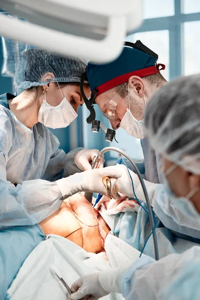 Chirurgen Männer und Frauen in einem Team während einer Operation über dem Operationstisch, Ärzte in modernen Geräten führen eine onkologische Operation durch — Stockfoto
