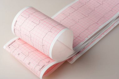 Kalp atış hızı ölçümleri olan elektrokardiyogram