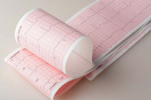 Electrocardiogram with heart rate readings