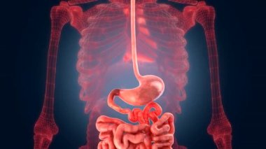 Xray tarama iç orans