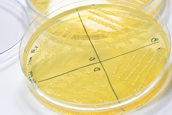 Petri Dish Ordförande — Stockfoto