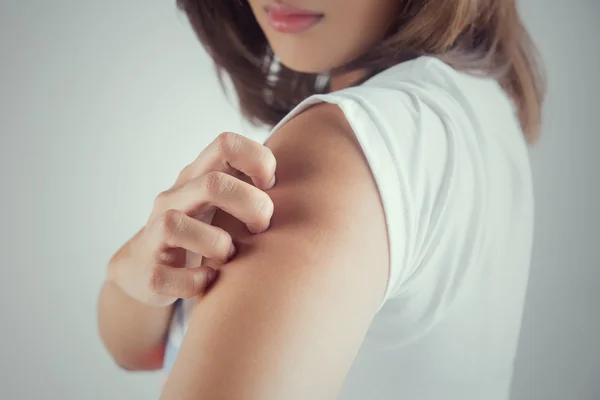 Mujer arañándose el brazo. —  Fotos de Stock