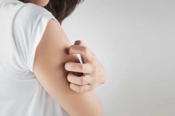 Frau kratzt sich am Arm. — Stockfoto