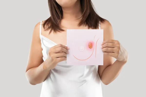 Žena Držící Světle Růžový Papír Obrázkem Rakoviny Prsu Prsní Tkáň — Stock fotografie
