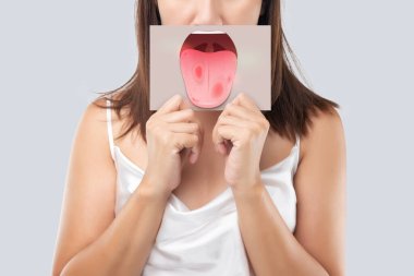 The woman show the picture of tongue problems, Illustration benign migratory glossitis on a brown paper, Behcet's Disease clipart