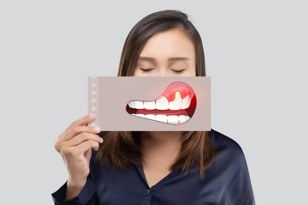 Mulher Asiática Camisa Azul Escuro Segurando Papel Com Periodontal Gengivite — Fotografia de Stock