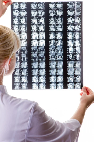 女性医師が x 線を見る — ストック写真