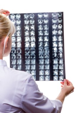 Doktor Röntgen arayan kadın