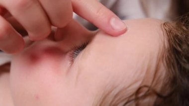 Kadın elinin evde yatan küçük anaokulu kızına serinletici krem sürdüğü, böcek ısırığı ve böcek ilacından kaynaklanan ülserlerin olduğu seçici odak noktasını kapat. Sinirli cilt konsepti