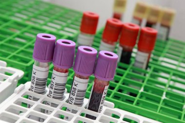 Kan bağışlamak için tüpler, yakın plan.