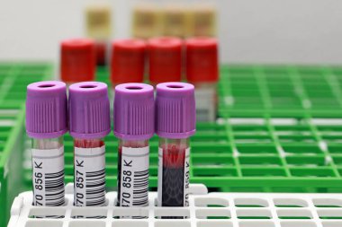 Kan bağışlamak için tüpler, yakın plan.