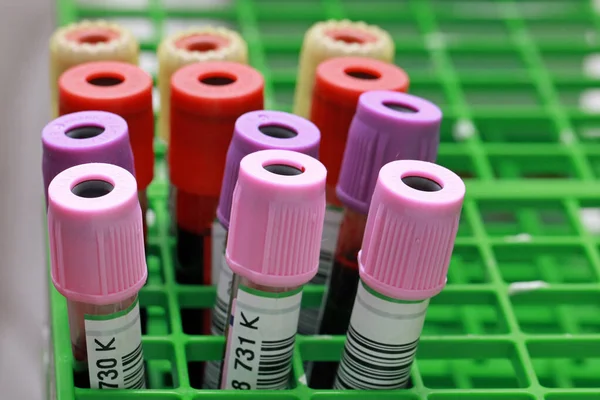 Kan bağışlamak için tüpler, yakın plan.