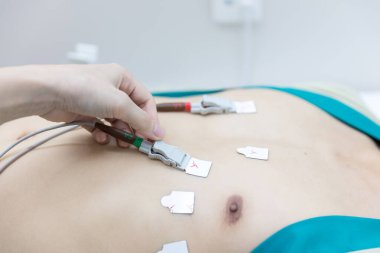 Genç hasta için Holter 'ı kullanarak kalp elektrokardiyogramı ya da monitör. Erkek sporcu kardiyak stres testi yapar. Her gün elektrokardiyogramı izlemek için Holter monitör cihazı takıyorum.. 