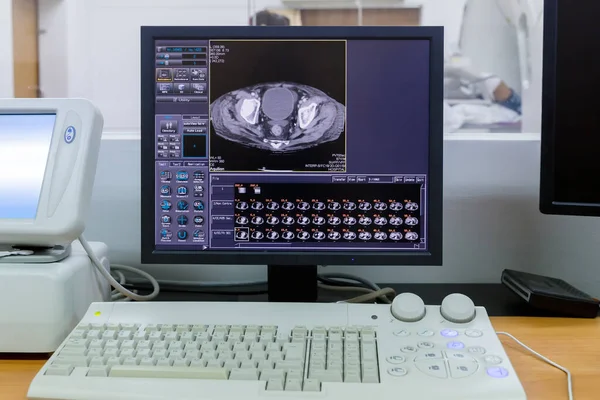 Computer Screen Showing MRI, CT Image Scan of the Brain. CT whole abdomen. Computer tomography scans in motion of lower and middle abdominal body area