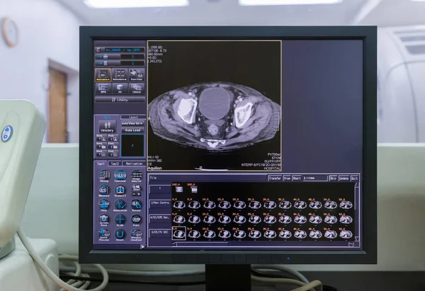 Mriを示すコンピュータ画面 脳のCt画像スキャン Ct全腹部 下腹部と中腹部の体領域の動きのコンピュータ断層撮影 — ストック写真