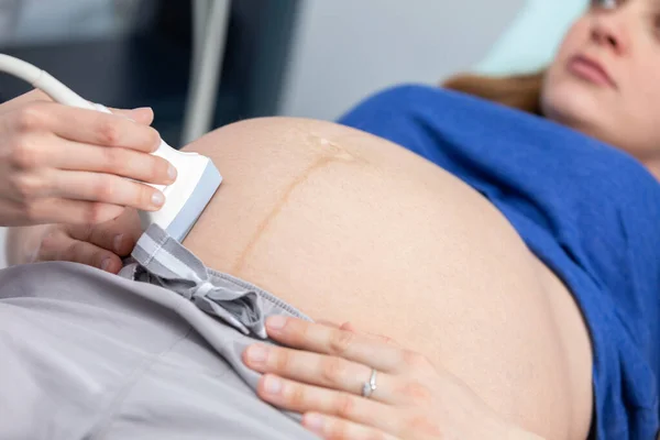 Vista de cerca del transductor de ultrasonido en el abdomen de una mujer embarazada. Oficina de ginecología. — Foto de Stock