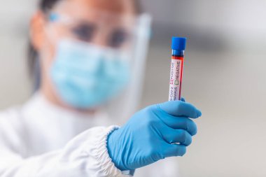 PPE kullanan hastane çalışanı 2019-nCoV testinde pozitif Coronavirus virüsü taşıyor..