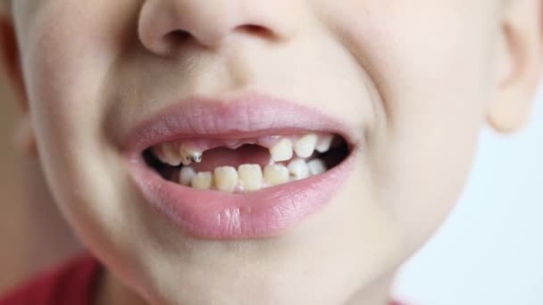 Primo piano di felice bello ragazzo mostrando il suo cambiando denti — Video Stock