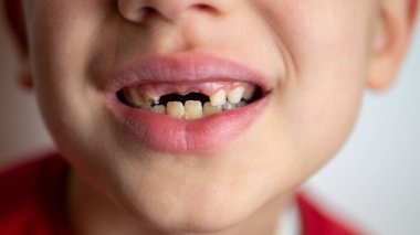 Yeni boşluğunu gösteren genç bir çocuk. Kapat.