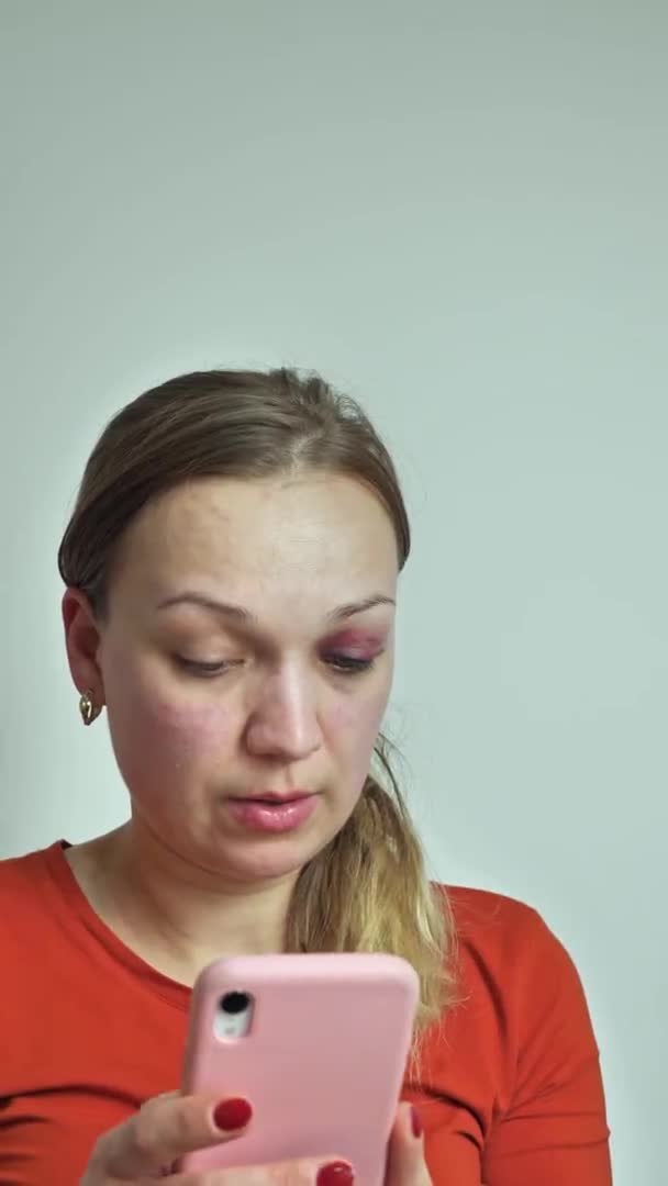 Video vertikal. Wanita dengan memar di bawah mata menulis SMS di telepon. kekerasan terhadap perempuan — Stok Video