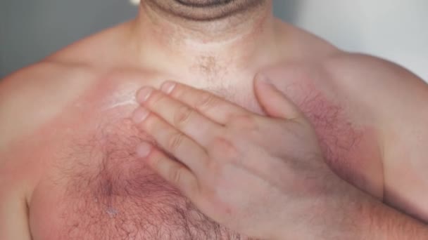 Primer plano mano del pecho del hombre la aplicación de crema de bálsamo calmante loción contra quemaduras solares piel — Vídeo de stock