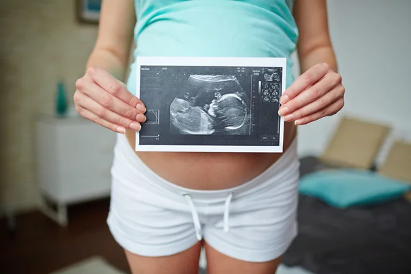 Woman holding sonogram — Stock Photo, Image