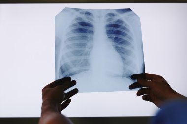 radyolog holding x-ray
