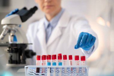 Whitecoat 'taki laboratuvar çalışanının eldivenli eli, mikroskopla incelemek için küçük bir şişe koronavirüs kan örneği alıyor.