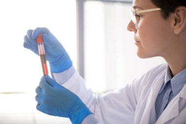 Beyaz yüzgeçli kadın bilim adamı ya da eczacı elindeki kırmızı sıvı maddeyle mataraya bakarken onun karakteristik özelliklerini inceliyor.