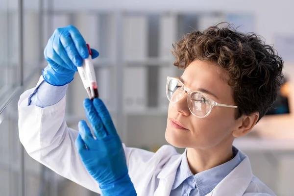 Beyaz Yüzgeçli Gözlüklü Ciddi Bir Kadın Laboratuvar Çalışanı Ellerinde Koronavirüs — Stok fotoğraf