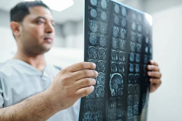 Kanser Hastası Üzgün Yetişkin Bir Hasta Doktor Röntgen Görüntülerini Izlerken — Stok fotoğraf