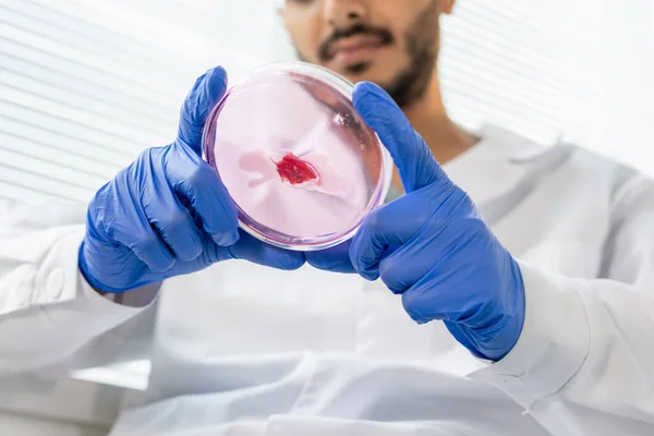 Manos Enguantadas Joven Trabajador Masculino Control Calidad Alimentos Placa Petri — Foto de Stock