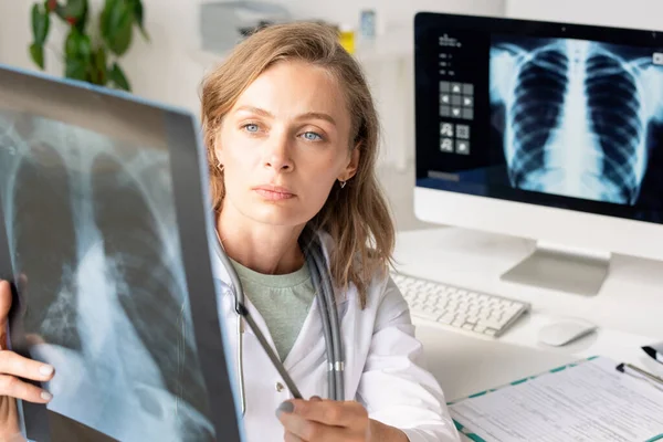 Young Serious Female Radiologist Whitecoat Pointing Ray Image Patient Lungs — Stock Photo, Image