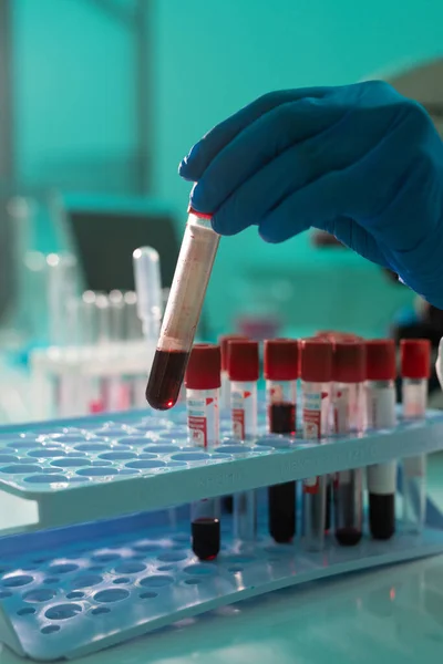 研究人员或实验室工作人员用手套手把装有血样的小瓶与其他样本一起放进细胞 — 图库照片