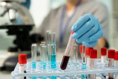 Steril eldivenli tanımlanamayan bir laboratuar çalışanı laboratuarda kan örneğini incelerken test tüpünü rafa koyuyor.