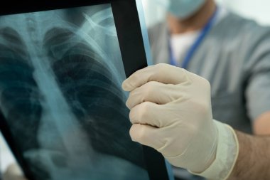 Tanımlanamayan doktorların eldiven giyip, akciğer röntgeni görüntülerini analiz ederken teşhis koymaları.