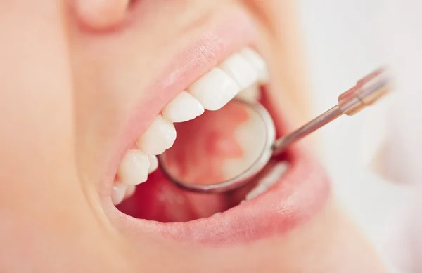 Open mouth during oral checkup — Stock Photo, Image