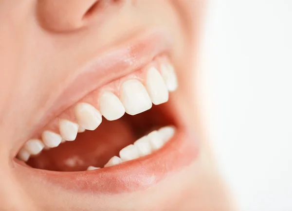 Sorriso dentato di donna — Foto Stock