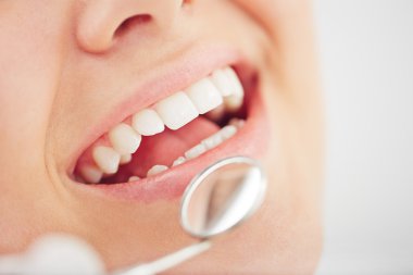 Check-up ayna açık ağız tarafından
