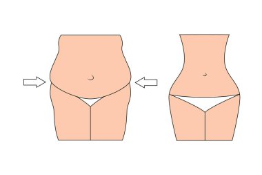 Kıvrımlı Vücut Silüeti Ağırlık Kaybetme Sağlığı Konsepti