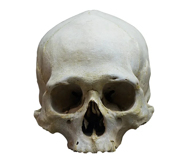 The skull of human on white background — Stock Photo, Image