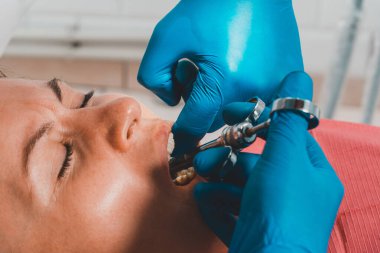 Lokal anestezi, dişçi bir karpal şırınga kullanır, 2020 dişçiye lokal anestezi verir.