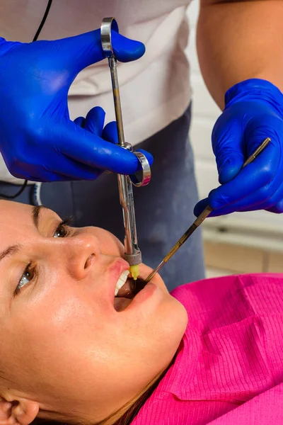 Lokal Anestezi Anestezi Şırınga Enjeksiyonu Dişçi Hastaya Iğne Yapıyor 2020 — Stok fotoğraf