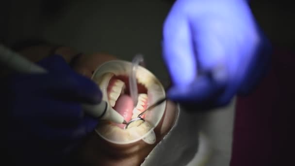 Le dentiste assure l'hygiène buccodentaire du patient par échographie. — Video