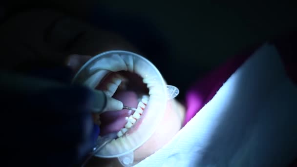 El dentista realiza la higiene bucal al paciente con ultrasonido. — Vídeo de stock