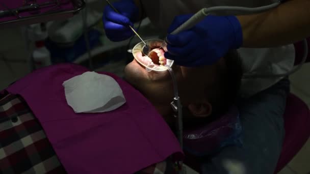 O dentista usa ultra-som para remover tártaro e placa dura nos dentes. — Vídeo de Stock