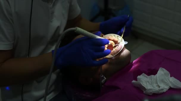 Higiene bucal, un hombre en la consulta de dentistas, extracción de sarro y placa en los dientes, el uso de ultrasonido. — Vídeos de Stock