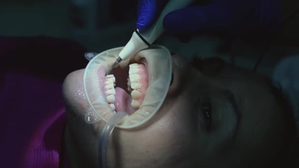 Patient Beim Zahnarzt Entfernung Von Zahnstein Durch Ultraschall 2020 — Stockvideo