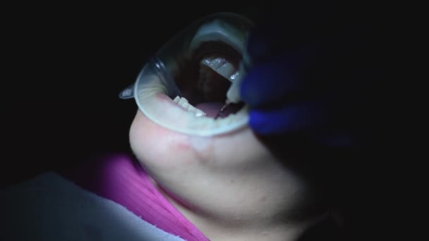 Der Zahnarzt Führt Die Mundhygiene Des Patienten Mit Ultraschall Durch — Stockvideo